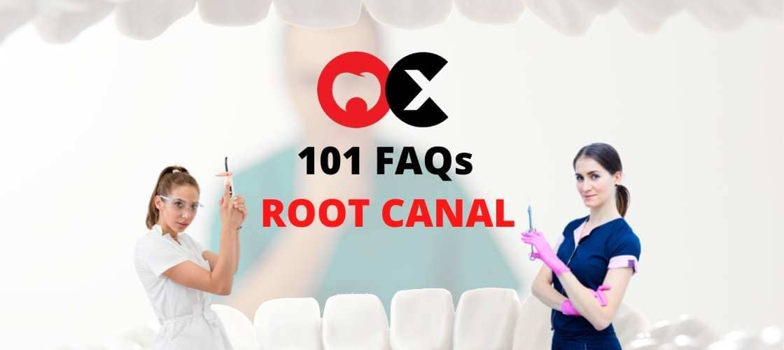 Tout sur le traitement de canal 101 FAQ